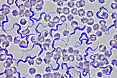 Trypanosoma brucei smear, light micrograph