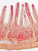 Villi, injected, light micrograph