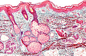 Sweat and sebaceous glands, light micrograph