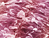 Surface of human skin, SEM