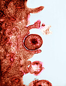 Chlamydia on surface of oviduct, TEM