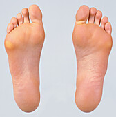 Underside of a pair of female feet