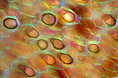 Chenopodium sp. with air bubbles, polarised light micrograph