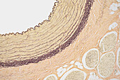Femoral artery wall, light micrograph
