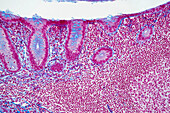Appendix lining, light micrograph