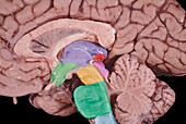 Diencephalon and midbrain structures