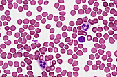 Blood smear, light micrograph