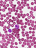 Blood smear, light micrograph