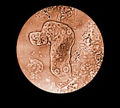 Entamoeba histolytica trophozoite, light micrograph