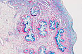 Cervix, light micrograph