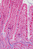 Small intestine, light micrograph