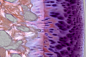 Finger bone, light micrograph