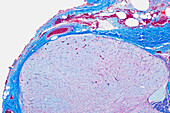 Posterior lobe of the pituitary gland, light micrograph