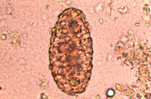 Infertile Ascaris lumbricoides egg, light micrograph