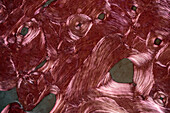 Bone tissue, light micrograph
