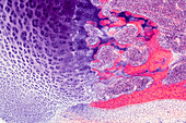 Foetal finger bone, light micrograph