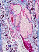 Hair follicle sebaceous gland, light micrograph
