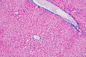 Liver lobule, light micrograph