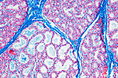 Lactating breast tissue, light micrograph