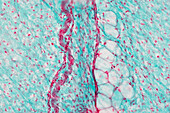 Mesentery, light micrograph