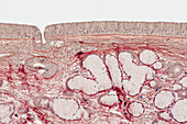 Nasal septum, light micrograph