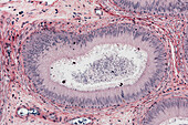 Epididymis, light micrograph