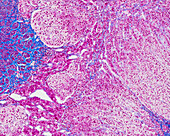 Adrenal gland, light micrograph