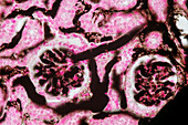 Kidney, light micrograph
