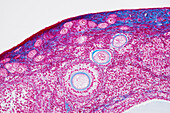 Ovarian follicles, light micrograph