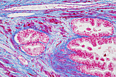 Prostate gland, light micrograph