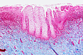 Vaginal wall, light micrograph