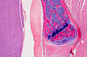 Foetal spine, light micrograph