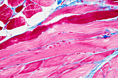 Tongue muscle fibres, light micrograph