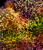 Cell infected by SARS-Cov-2 virus particles, SEM