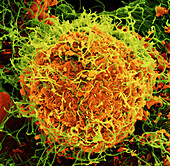 Ebola virus particles, SEM