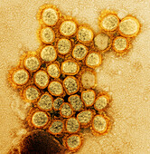 Alpha variant covid-19 coronavirus particles, TEM