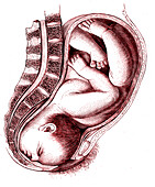 Foetal childbirth position, 19th century illustration