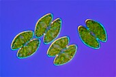 Cosmarium raciborski, green algae, light micrograph