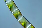 Draparnaldia green algae, light micrograph