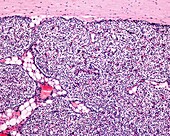 Child parathyroid gland, light micrograph
