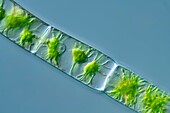 Zygnema green algae, light micrograph