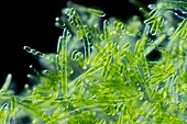 Ophiocytium green algae, light micrograph