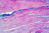 Human smooth muscle, light micrograph