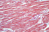 Human cardiac muscle, light micrograph