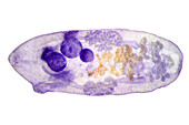 Liver fluke, light micrograph