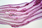 Liver fluke eggs, light micrograph