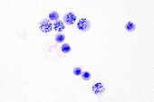 Human chromosomes, light micrograph