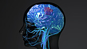Brain cancer, conceptual illustration