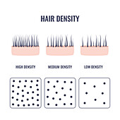 Hair density types, conceptual illustration