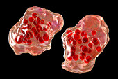 Measles virus infection, illustration